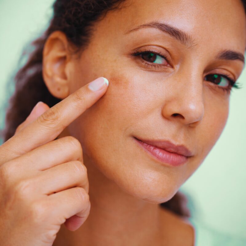 Targeted Dark Spot Care, 1% Kojic Acid